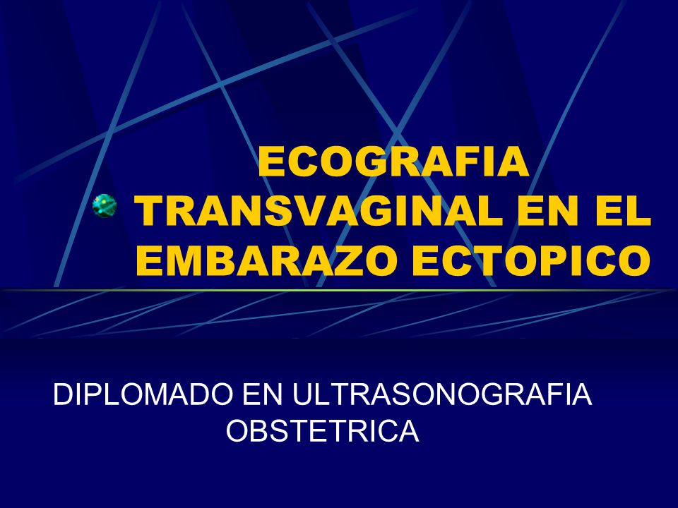 Embarazo ectopico se detecta en ecografia